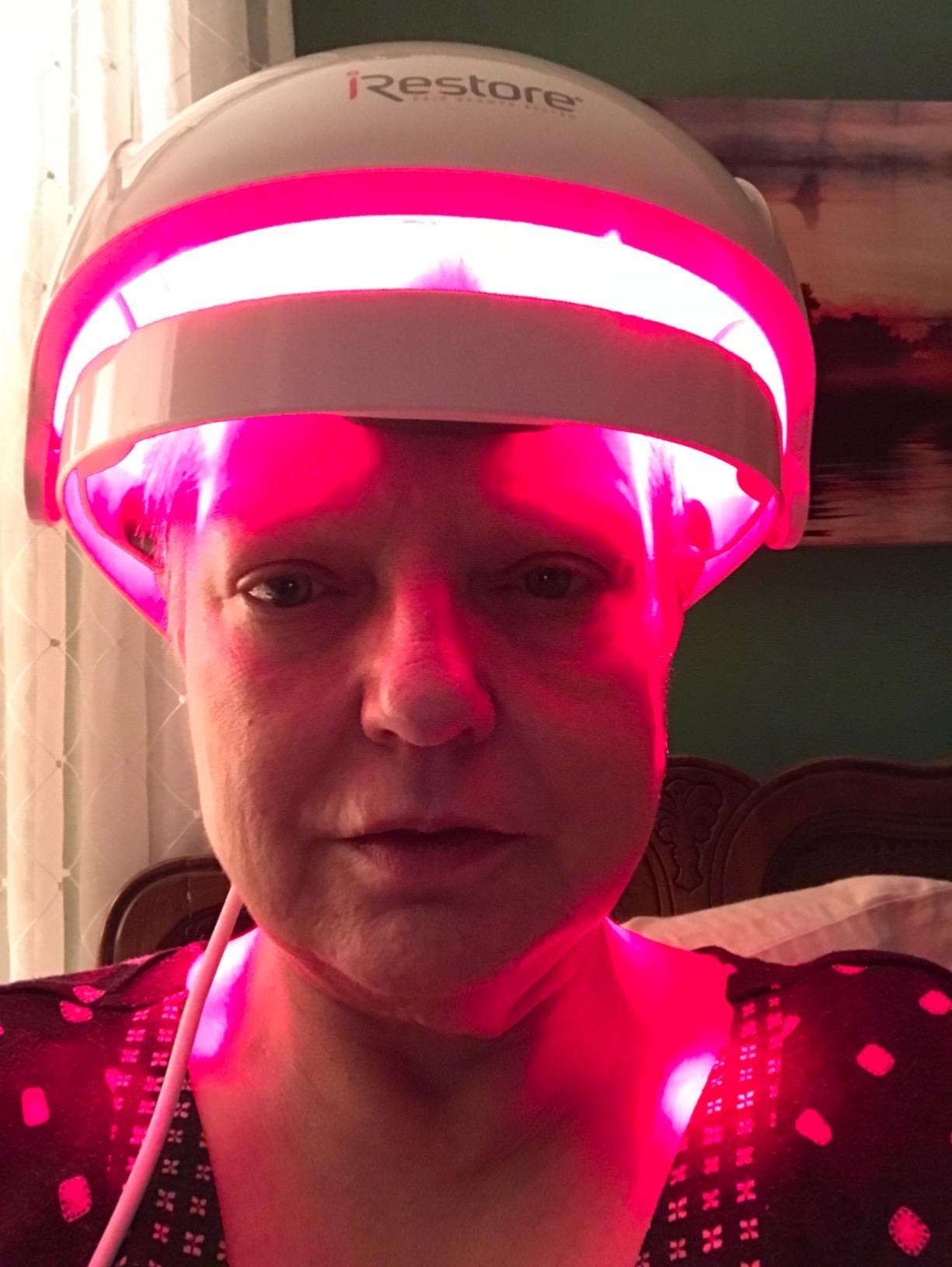 iRestore Essential - Laser Red Light Therapy for Hair Growth - FDA Cleared Hair Loss, Hair Thinning & Alopecia Treatment for Men & Women - Laser Cap for Hair Regrowth Stimulate Denser Fuller Hair customer photo 1