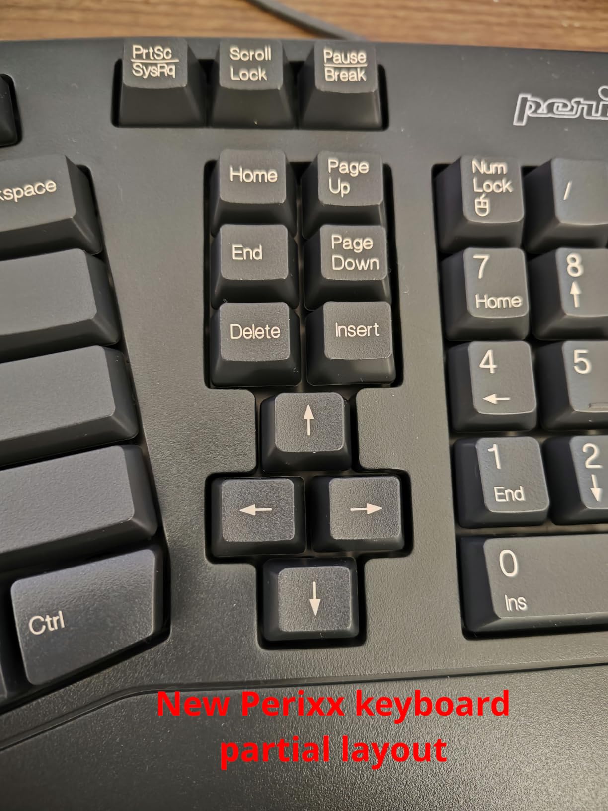 Perixx PERIBOARD-512B Wired Ergonomic Keyboard - Split Keyboard, Wrist Rest, Natural Typing - Wired USB Connectivity - US English - Black customer photo 2