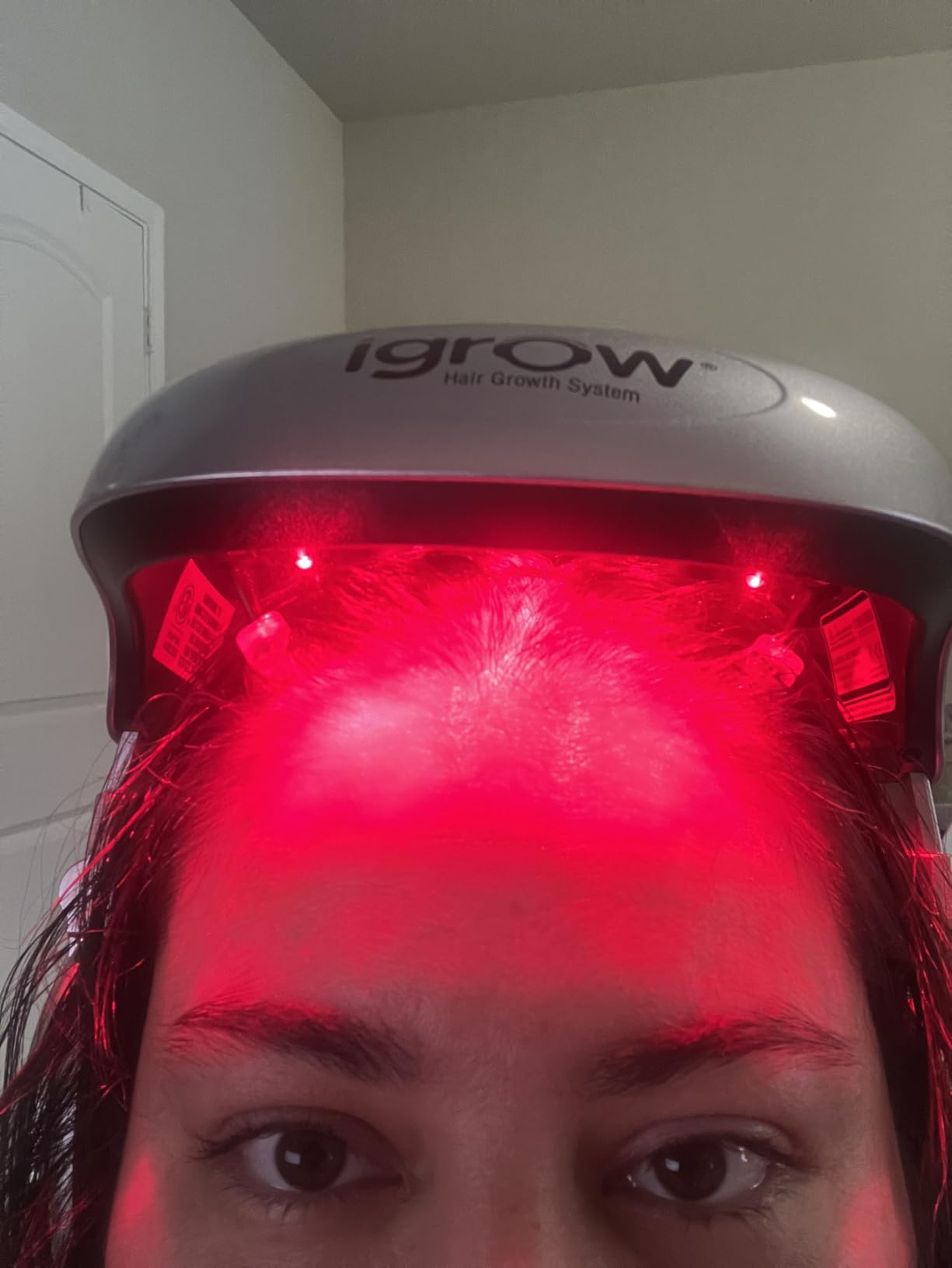iGrow Laser Hair Growth System - Red Light Helmet Therapy, Clinically Proven, FDA Cleared Laser Cap Hair Growth for Men & Women customer photo 1