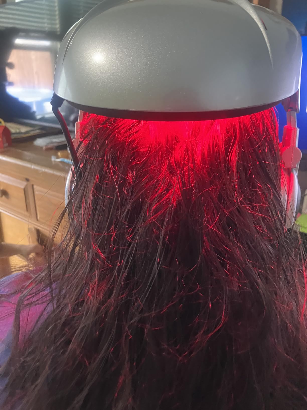 iGrow Laser Hair Growth System - Red Light Helmet Therapy, Clinically Proven, FDA Cleared Laser Cap Hair Growth for Men & Women customer photo 2